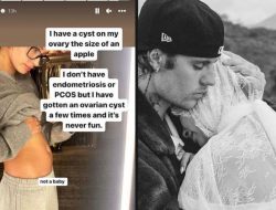 Sebelum Umumkan Kehamilan, Hailey, Istri Justin Bieber Idap Kista Ovarium