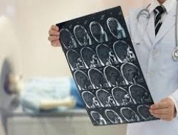 5 Layanan Kesehatan yang Dapat Diakses Lewat Telemedicine